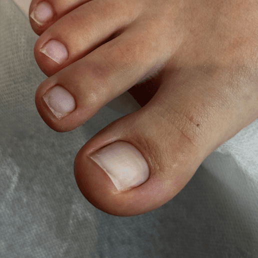 Dry Pedicure (No Polish)